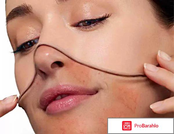 Причины появления сосудистых звездочек на лице отрицательные отзывы