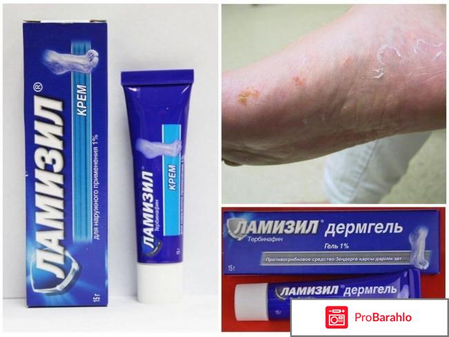 Ламизил мазь инструкция цена отзывы украина обман