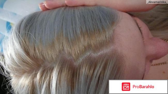 Ирида реальные отзывы