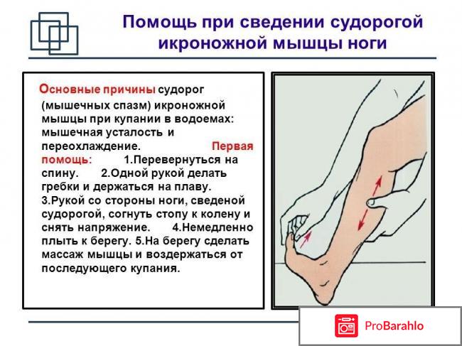 Судорога икроножной мышцы — Причины и лечение реальные отзывы