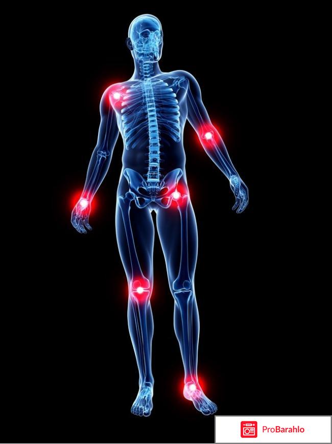 Хондроитин уколы цена отзывы отрицательные отзывы