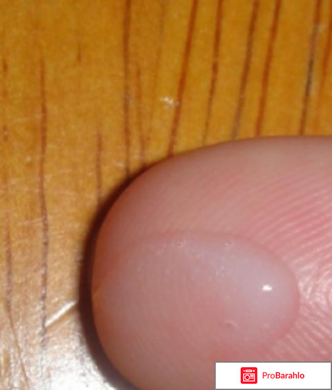 Панавир гель от папиллом обман