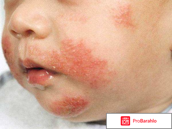 Кортексин детям 