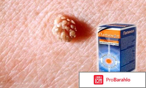 Папинол отзывы реальные обман