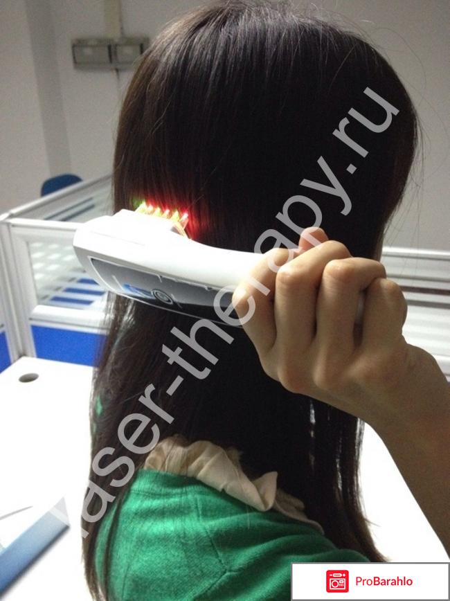 Лазерная расческа от выпадения волос отзывы врачей отрицательные отзывы