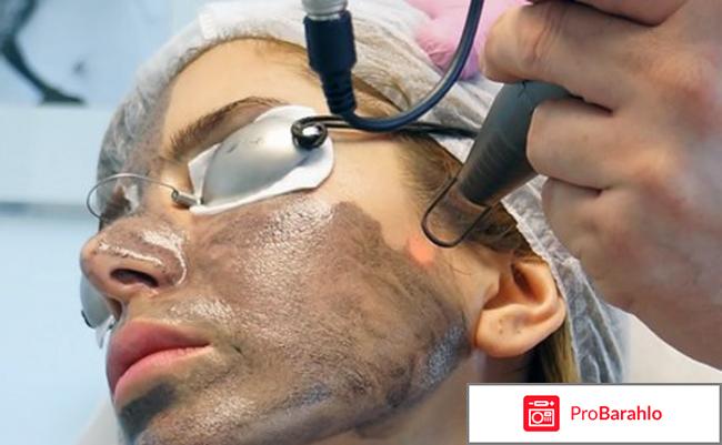 Карбоновый пилинг отзывы обман