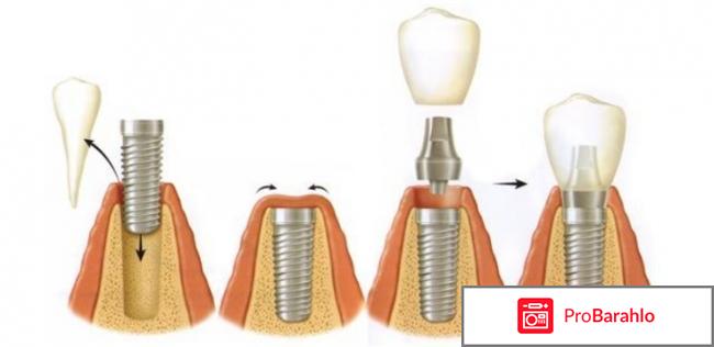 Врач имплантолог отзывы обман