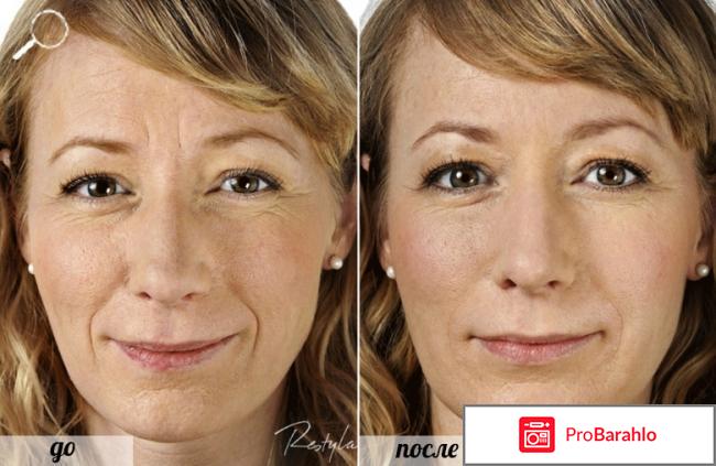 Лаеннек отрицательные отзывы 