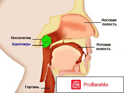 Барбарис комп иов-малыш отрицательные отзывы