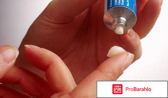 Зуд в заднем проходе у женщин отзывы реальные отзывы