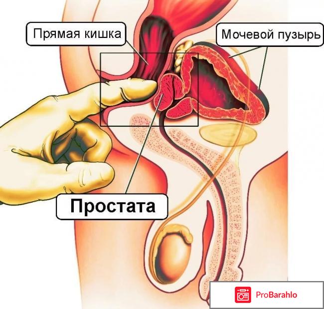 Эретон аппарат урологический отзывы форум 