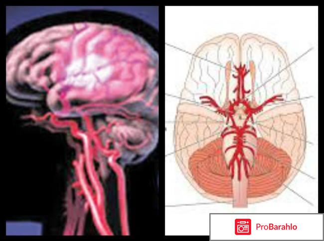 Острая недостаточность мозгового кровообращения отрицательные отзывы