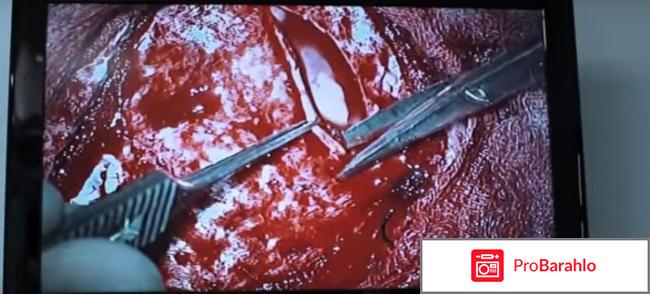 Фильм врач отзывы реальные отзывы