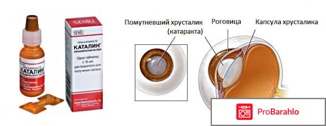 Каталин глазные капли отзывы форум 