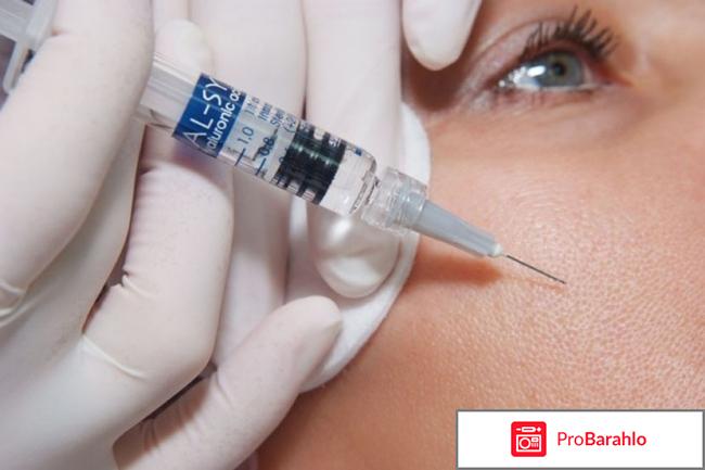 Гиалуронка под глаза 