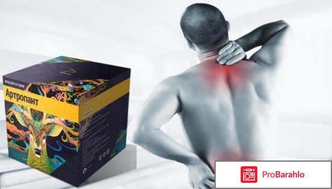 Отзывы о креме артропант 