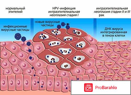 Papillock средство от папиллом и бородавок отрицательные отзывы