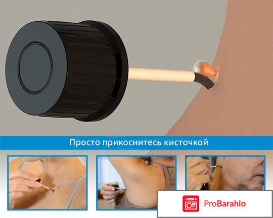 Сани скин от папиллом цена отрицательные отзывы