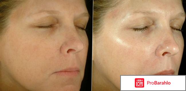 Либридерм альгинатная маска гиалуроновая отрицательные отзывы