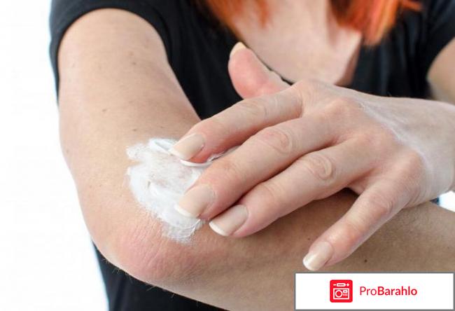 Мазь цинокап цена отзывы обман