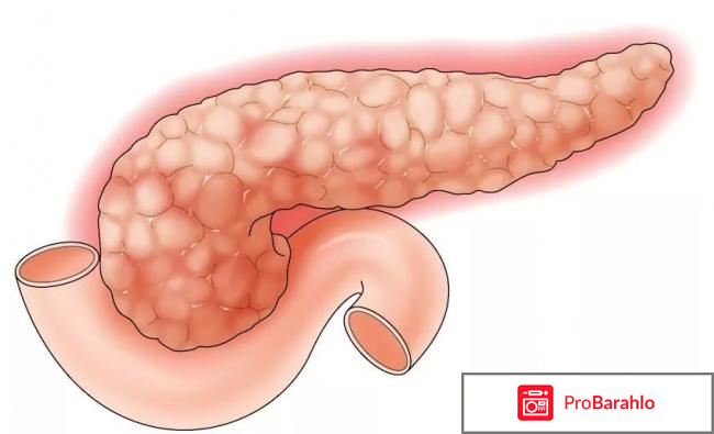 Список лекарств при панкреатите 