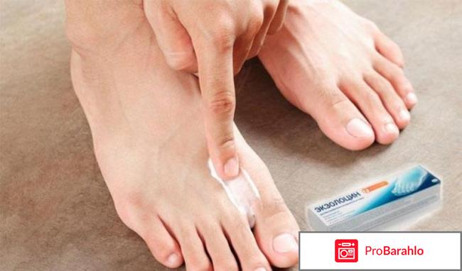 Экзолоцин развод отрицательные отзывы