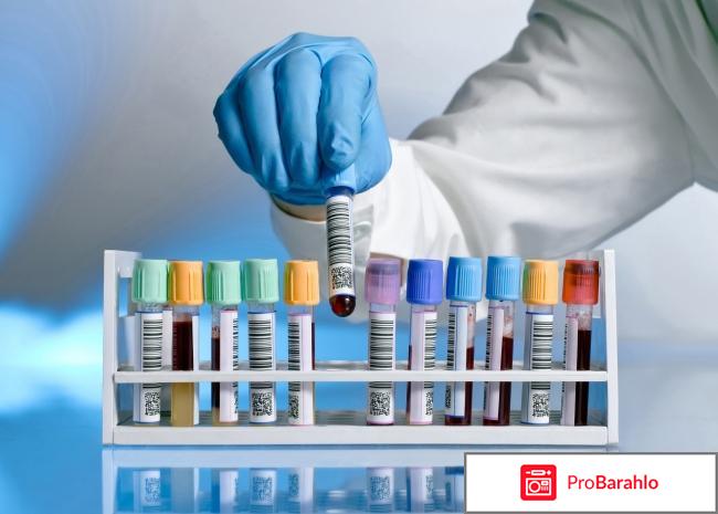 Показатель соэ в анализе крови отрицательные отзывы