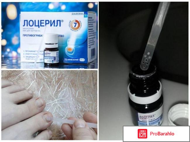 Лоцерил цена отзывы аналоги обман
