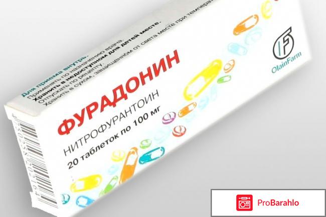 Цистит - симптомы, лечение, профилактика, причины отрицательные отзывы