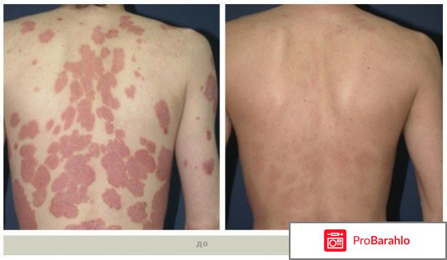 C-dermic отрицательные отзывы