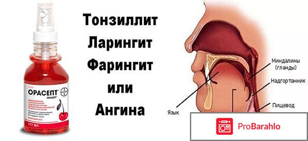 Орасепт отрицательные отзывы