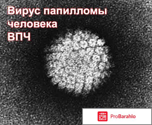 Вирус папилломы человека у женщин в гинекологии реальные отзывы