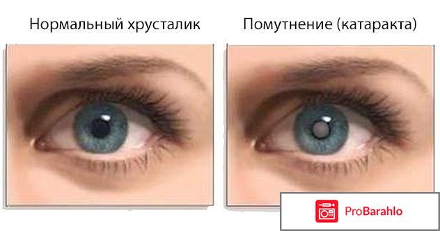 Орлит Premium реальные отзывы отзывы владельцев