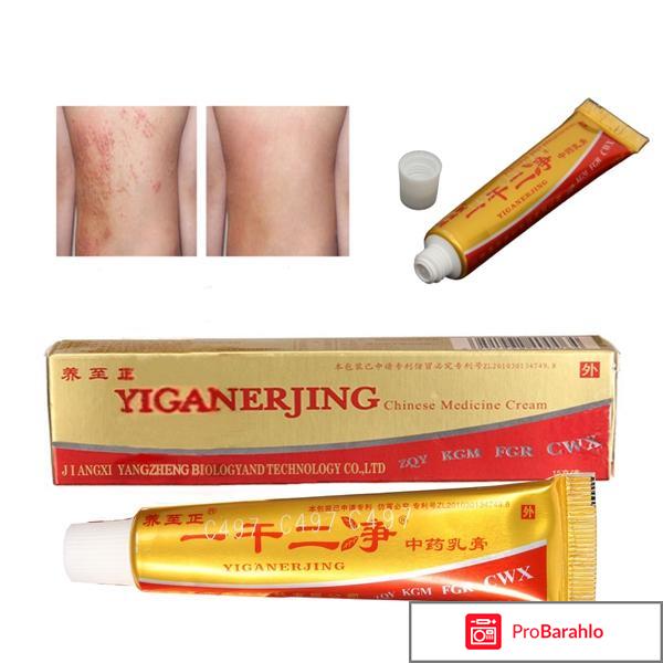 Китайский крем от псориаза отрицательные отзывы