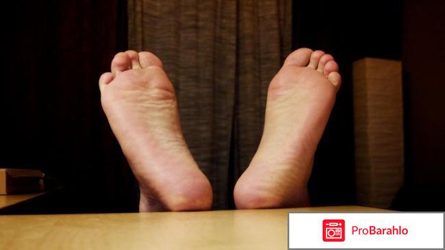 Потеют ноги что делать 