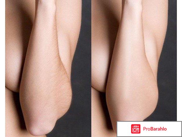 Осветление волос на руках в домашних условиях 