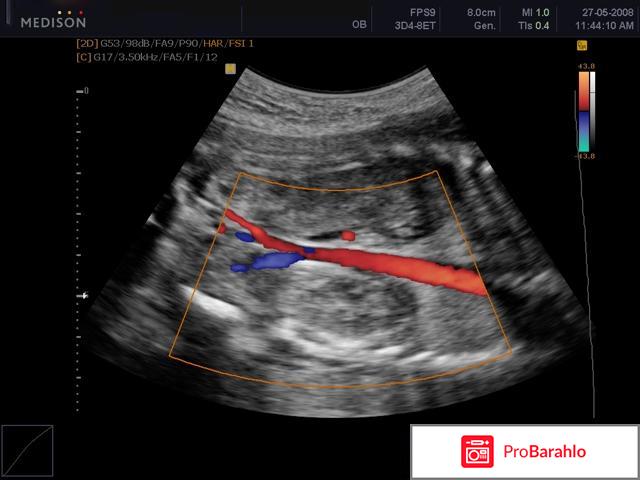 Узи брахиоцефальных сосудов головы и шеи реальные отзывы