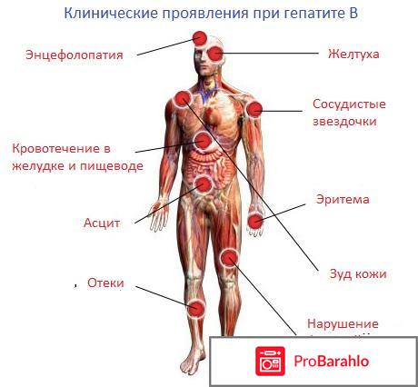 Гепатит В: диета, препараты и народное лечение 