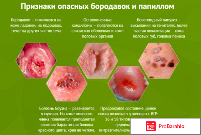 Папиловит (Papilovit) 