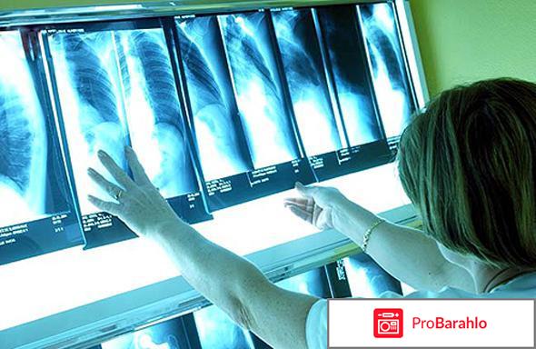 Юрий бурлан отрицательные отзывы отрицательные отзывы