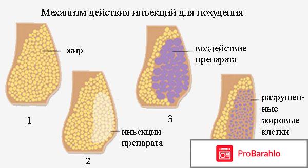 Уколы для похудения в живот стоимость отзывы отрицательные отзывы