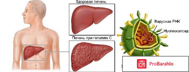 Mpiviropack (Совосбувир) обман