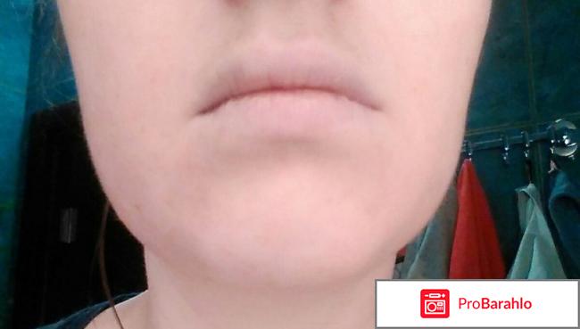 ROMANTIC BEAR отрицательные отзывы