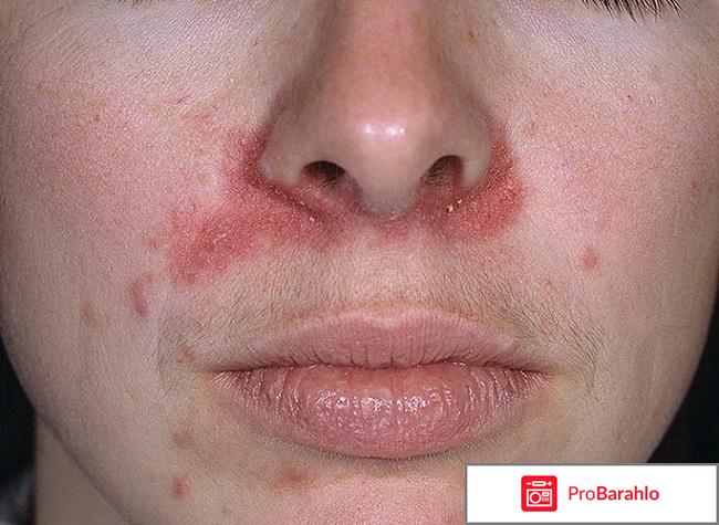 Крем Biologique Recherche Dermopurifiante реальные отзывы