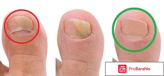 Стоп-Актив - примитивный развод-лохотрон отрицательные отзывы