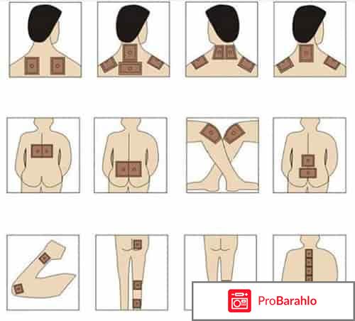 Ортопедический пластырь отрицательные отзывы