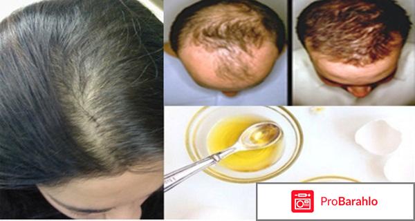 Выпадение волос форум отзывы отрицательные отзывы