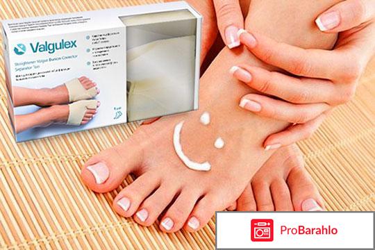 Вальгулекс отзывы обман